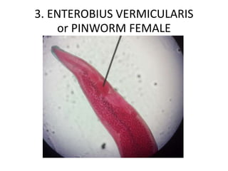 3. ENTEROBIUS VERMICULARIS
or PINWORM FEMALE
 