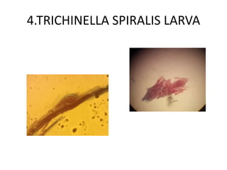 4.TRICHINELLA SPIRALIS LARVA
 