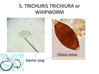 5. TRICHURIS TRICHIURA or
WHIPWORM
bipolar plug
 