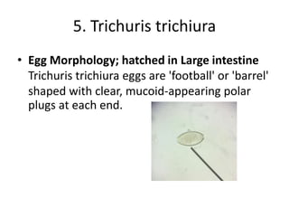 5. Trichuris trichiura
• Egg Morphology; hatched in Large intestine
Trichuris trichiura eggs are 'football' or 'barrel'
shaped with clear, mucoid-appearing polar
plugs at each end.
 