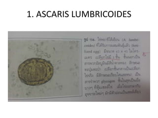 1. ASCARIS LUMBRICOIDES
 