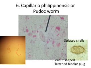 6. Capillaria philippinensis or
Pudoc worm
Peanut shaped
Flattened bipolar plug
Striated shells
 