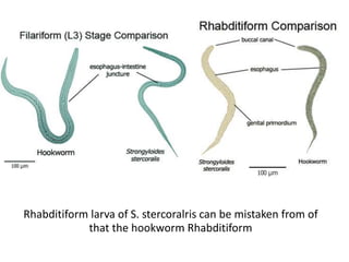 Rhabditiform larva of S. stercoralris can be mistaken from of
that the hookworm Rhabditiform
 