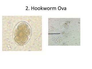 2. Hookworm Ova
 