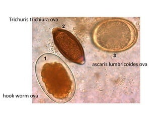 ascaris lumbricoides ova
Trichuris trichiura ova
hook worm ova
 
