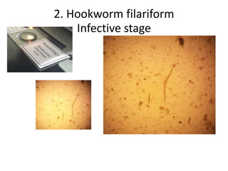 2. Hookworm filariform
Infective stage
 