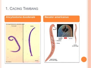 1. CACING TAMBANG
Ancylostoma duodenale Necator americanus
 