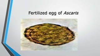 Fertilized egg of Ascaris
 