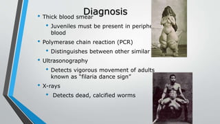 Diagnosis• Thick blood smear
• Juveniles must be present in peripheral
blood
• Polymerase chain reaction (PCR)
• Distinguishes between other similar species
• Ultrasonography
• Detects vigorous movement of adults
known as “filaria dance sign”
• X-rays
• Detects dead, calcified worms
 