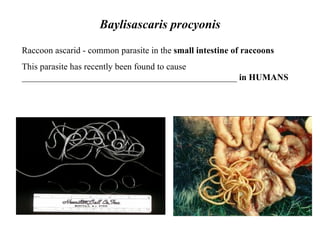 Baylisascaris procyonis Raccoon ascarid - common parasite in the  small intestine of raccoons This parasite has recently been found to cause ________________________________________________  in HUMANS   