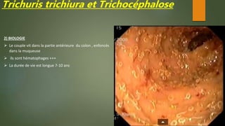 Trichuris trichiura et Trichocéphalose
2) BIOLOGIE
 Le couple vit dans la partie antérieure du colon , enfoncés
dans la muqueuse
 ils sont hématophages +++
 La durée de vie est longue 7-10 ans
 
