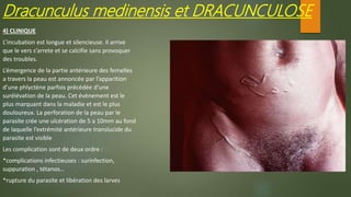 4) CLINIQUE
L’incubation est longue et silencieuse. Il arrive
que le vers s’arrete et se calcifie sans provoquer
des troubles.
L’émergence de la partie antérieure des femelles
a travers la peau est annoncée par l’apparition
d’une phlyctène parfois précédée d’une
surélévation de la peau. Cet évènement est le
plus marquant dans la maladie et est le plus
douloureux. La perforation de la peau par le
parasite crée une ulcération de 5 a 10mm au fond
de laquelle l’extrémité antérieure translucide du
parasite est visible
Les complication sont de deux ordre :
*complications infectieuses : surinfection,
suppuration , tétanos…
*rupture du parasite et libération des larves
Dracunculus medinensis et DRACUNCULOSE
 