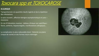 4) CLINIQUE
*proportionnel a la quantité o’œufs ingérés et de la répétition
des infestations.
Le plus souvent , affection bénigne asymptomatique et auto –
résolutive
En cas d’infestation massive : tableau clinique non spécifique :
fievre, asthénie, hépatomégalie, manifestations allergiques..
La complication la plus redoutable étant l’atteinte occulaire
(risque de cecité) et des formes neuro-méningés
Toxocara spp et TOXOCAROSE
 