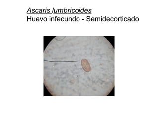 Ascaris lumbricoides
Huevo infecundo - Semidecorticado
 