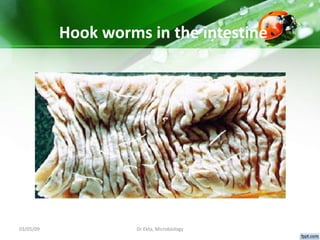 03/05/09 Dr Ekta, Microbiology
Hook worms in the intestine
 