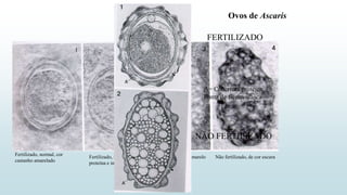 Ovos de Ascaris
Fertilizado, normal, cor
castanho amarelado
Fertilizado, sem cobertura de
proteína e incolor
Não fertilizado amarelo
claro
Não fertilizado, de cor escura
FERTILIZADO
NÃO FERTILIZADO
A= Cobertura protéica
Ponta de flecha=casca
 