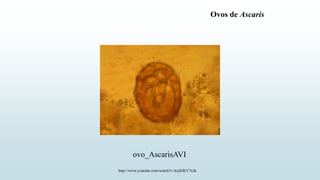 http://www.youtube.com/watch?v=krjSJKV7xJk
ovo_AscarisAVI
Ovos de Ascaris
 