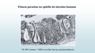 Fêmeas parasitas no epitélio do intestino humano
70-100 vermes= 1000 ovos/dia=larvas (assintomáticos)
 