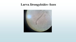 Larva Strongyloides- fezes
 