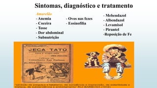 Sintomas, diagnóstico e tratamento
Amarelão
- Anemia
- Coceira
- Tosse
- Dor abdominal
- Subnutrição
- Ovos nas fezes
- Eosinofilia
- Mebendazol
- Albendazol
- Levamisol
- Pirantel
-Reposição de Fe
 