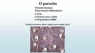 O parasito
- Parasita humano
- Peças bucais rudimentares
- 3–5cm
- Vivem no ceco e cólon
- 2-10 parasitos (1000)
Trichuris trichiura: thrix= cabelo, oura=cauda. Erro!
 