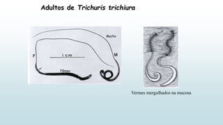 Adultos de Trichuris trichiura
Macho
Fêmea
Vermes mergulhados na mucosa
 