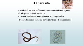 O parasito
- Adultos:♀3-4 mm e ♂2 mm na mucosa duodeno e jejuno
-♀ viviparas -350 -1.500 larvas
-Doença humana: carne de porco (Levítico e Deuteronômio)
- Larvas: encistadas no tecido muscular esquelético
 