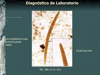 Diagnóstico de Laboratorio




Larva rabditoide en lugol
(primordio genital
visible)

                                                      Canal bucal corto




                            180 – 380 u X 14 – 20 u
 