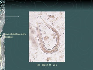 Larva rabditoide en suero
fisiológico




                            180 – 380 u X 14 – 20 u
 