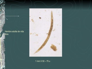 Hembra adulta de vida
libre




                        1 mm X 50 – 75 u
 