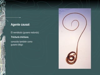 Agente causal:

El nemátodo (gusano redondo)
Trichuris trichiura,
conocido también como
gusano látigo
 