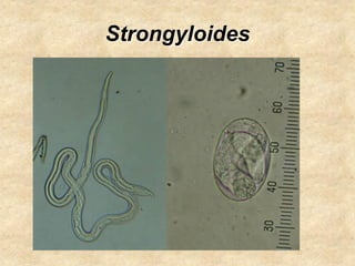 Strongyloides
 