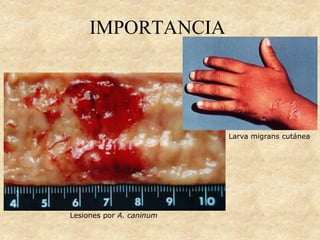 IMPORTANCIA
Larva migrans cutánea
Lesiones por A. caninum
 