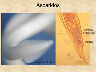 Ascáridos
Alas cervicales
Ventosa
precloacal
cloaca
 