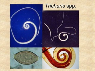 Trichuris spp.
 