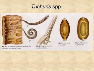 Trichuris spp.
 
