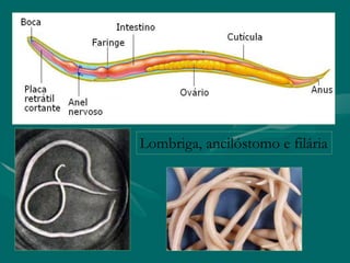 Lombriga, ancilóstomo e filária
 
