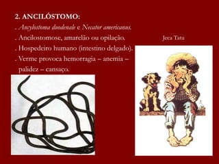 2. ANCILÓSTOMO:
. Ancylostoma duodenale e Necator americanus.
. Ancilostomose, amarelão ou opilação.
. Hospedeiro humano (intestino delgado).
. Verme provoca hemorragia – anemia –
palidez – cansaço.
Jeca Tatu
 
