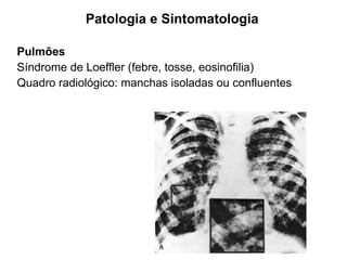 Patologia e Sintomatologia
Pulmões
Síndrome de Loeffler (febre, tosse, eosinofilia)
Quadro radiológico: manchas isoladas ou confluentes
 