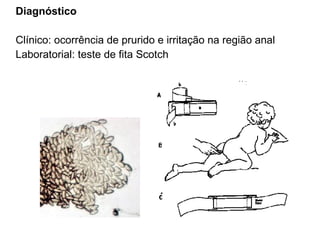 Diagnóstico
Clínico: ocorrência de prurido e irritação na região anal
Laboratorial: teste de fita Scotch
 