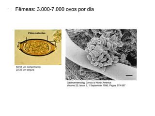 •
Fêmeas: 3.000-7.000 ovos por dia
Gastroenterology Clinics of North America
Volume 25, Issue 3, 1 September 1996, Pages 579-597
50-55 µm comprimento
22-23 µm largura
Pólos salientes
 