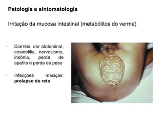 Patologia e sintomatologia
Irritação da mucosa intestinal (metabólitos do verme)
•
Diarréia, dor abdominal,
eosinofilia, nervosismo,
insônia, perda de
apetite e perda de peso
•
Infecções maciças:
prolapso do reto
 