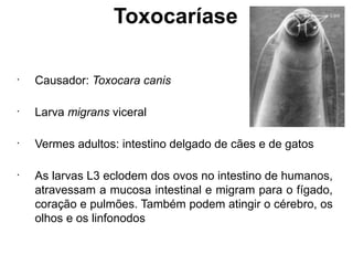 Toxocaríase
•
Causador: Toxocara canis
•
Larva migrans viceral
•
Vermes adultos: intestino delgado de cães e de gatos
•
As larvas L3 eclodem dos ovos no intestino de humanos,
atravessam a mucosa intestinal e migram para o fígado,
coração e pulmões. Também podem atingir o cérebro, os
olhos e os linfonodos
 