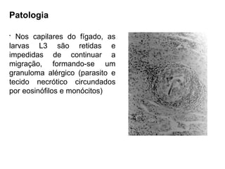 Patologia
•
Nos capilares do fígado, as
larvas L3 são retidas e
impedidas de continuar a
migração, formando-se um
granuloma alérgico (parasito e
tecido necrótico circundados
por eosinófilos e monócitos)
 