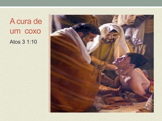 A cura de 
um coxo 
Atos 3 1:10 
 