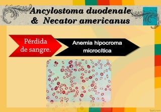 Ancylostoma duodenale
& Necator americanus
 