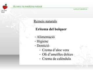 Remeis naturals Alimentació  Higiene Dentició Crema d’aloe vera Oli d’ametlles dolces Crema de calèndula Eritema del bolquer 