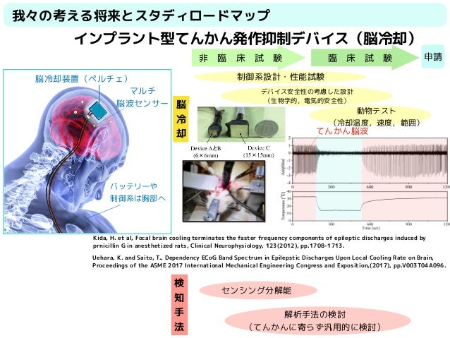 連成非線形振動子を用いたてんかん波焦点とその周辺脳波との関係性の解析(改訂版) 連成非線形振動子を用いたてんかん波焦点とその周辺脳波との関係性の解析(改訂版)