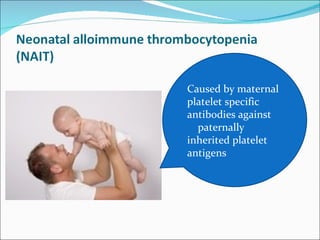 Caused by maternal
platelet specific
antibodies against
  paternally
inherited platelet
antigens
 