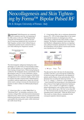 Neocollagenesis and Skin Tightening by Forma™ Bipolar Pulsed RF
D
‫ ‏‬r. E. Krieger, University of Ferrara - Italy

B

ackground: Radiofrequencies are commonly
used in medicine since the very beginning of
the 20th century. In the year 1907 Nagelschmidt
coined the term Diathermy to indicate the heating of living tissue produced by the conversion of
high frequency currents in heat without being accompanied by painful muscle contraction that occurs while inducing low frequencies currents.

The electromagnetic endogenous heating has some
advantages over other forms of tissue heating (conduction, infrared radiation, etc.) In particular long waves
allow heating of deeper layers. While during heating by
conduction, the temperature decays exponentially to the
physiological value (37º) in few millimeters, electromagnetic heating allows more homogenous distribution
of temperature in few centimeters depths, which cannot
be reached with other external means. Radiofrequency
in aesthetic medicine applications, targets the reticular
dermis matrix, aiming to increase the intra-dermal temperature in order to obtain two different physiological
effects:
1. A short term effect, so called "BBQ Effect" or
"Shrinking Effect": an immediate contraction of the
existence collagen fibers and initial protein denaturation
induced by heat, which reacts by a reorganization of the
tridimensional protein structure. This reaction generates
a perceptible skin toning and a quite visible transitional
but visible facial lift-up.

2. A long lasting effect, due to continuous denaturation
process (5% - 30% of total collagen fibers in the treated
area) and the formation of a damaged area with an
inflammatory component that induce finally a reparative
response. The flogistic stimulation select some important fibroblast's subpopulations that have an important
role in fibrosis formation; Interleukin IL-4 bond to CD40 of fibroblasts with pro-fibrotic reaction and stimulation of production new collagen.

The physical law that is the basis for the physiological effect of the RF, is given through the modification
of electrical camp in the treated area, the changing of
polarity and the fluency of ions and molecules, which
determine heat according the following formula: J = I x
R x T (J = energy, I = current, R = tissue impedance, T
= time) Generally the heat produced is developed gradually in 3mm to 9 mm depth and determines heating up
to 55ºC – 65 ºC. Forma™ ST applicator is a bipolar
pulsed radiofrequency with cooling system of the electrodes , able to deliver up to 100 J/cm³ in less than 200
ms. This fractional mode of energy delivery, generate an
immediate peak of about 60ºC within the dermis layer.
This results as a firmly effective stimulation for the
consequent reparative desired response.

 